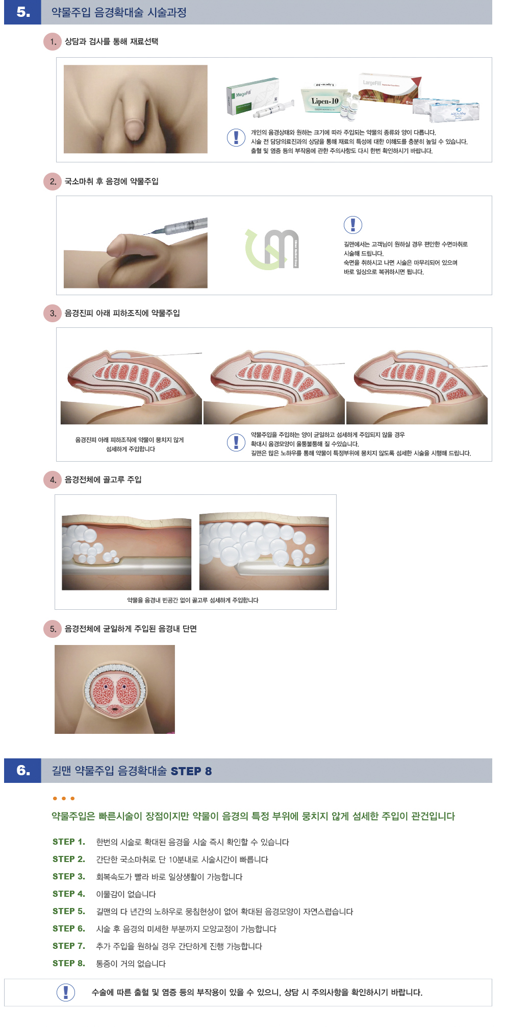 약물주입 음경확대