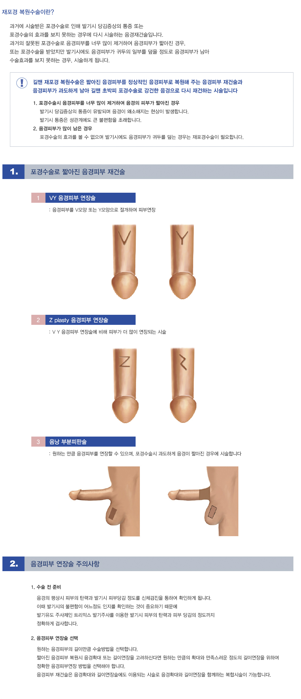 재포경복원수술